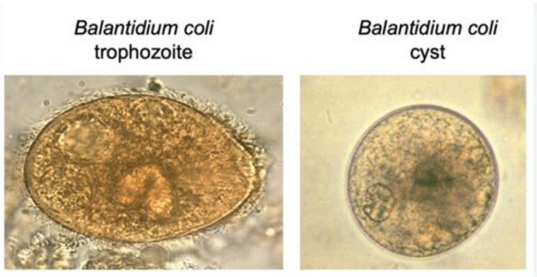 Understanding Balantidium Coli Classification Morphology Diagnosis And Effective Treatment 0546