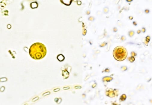 Entamoeba hartmanni cyst