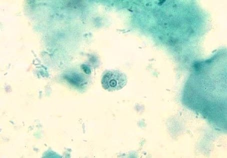 Entamoeba hartmanni Trophozoite