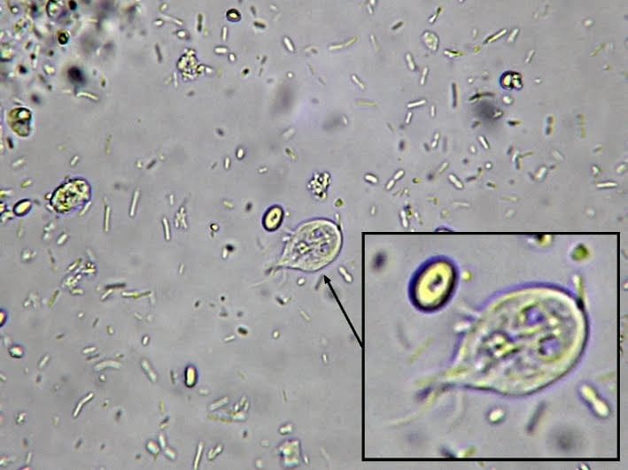 Giardia lamblia trophozoite under microscope