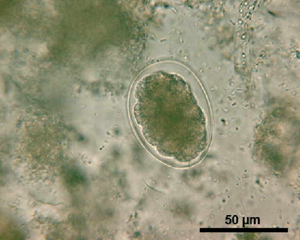Hookworm eggs under microscope