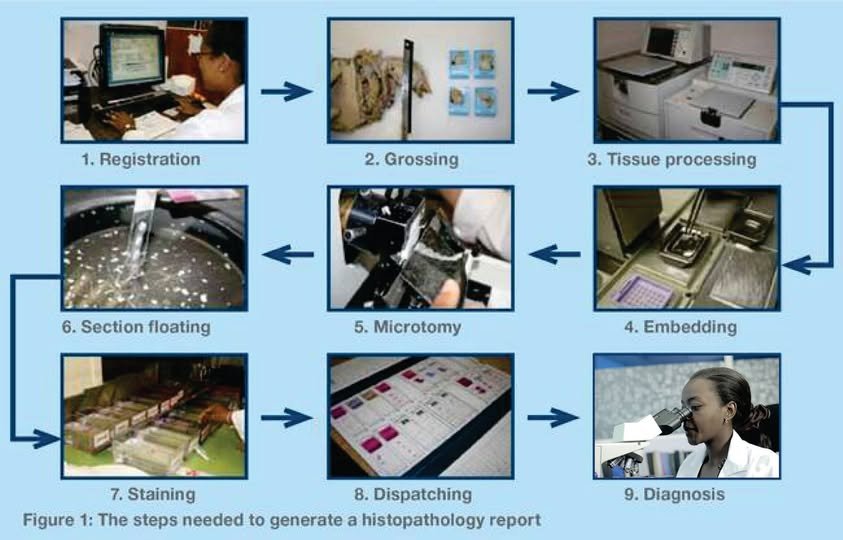 Tissue fixation and Processing step by step - Image Cerba Lancet Kenya