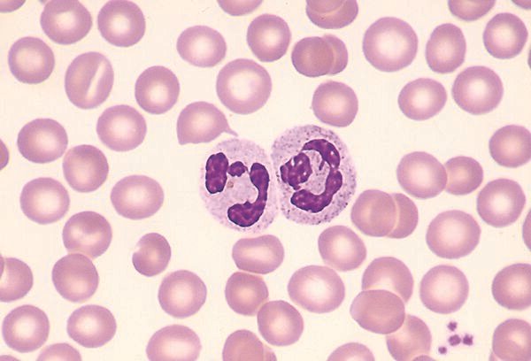 Neutrophils-Cellular Defense Mechanisms